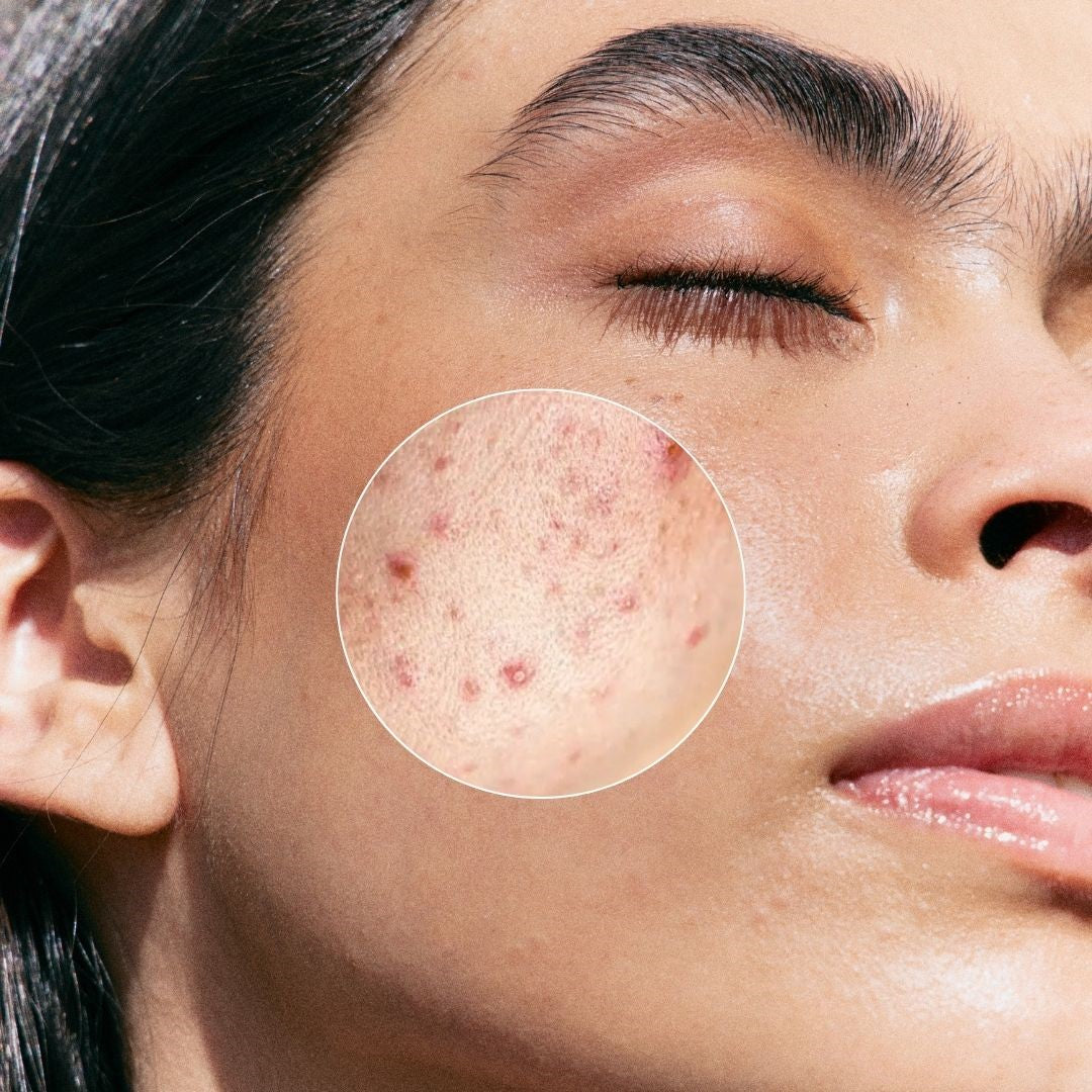 Purifying BHA Serum 30 ml